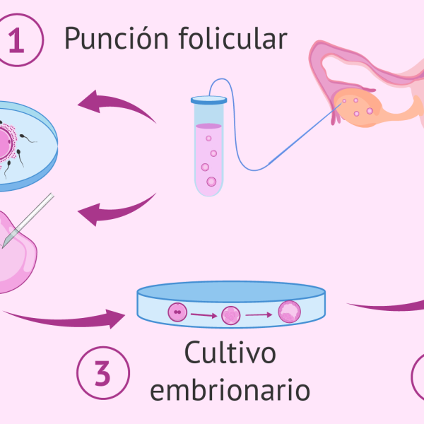 Tecnologías de FIV: Avances que Transforman la Paternidad